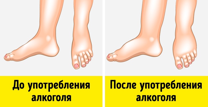 9 признаков алкогольной непереносимости, о которых многие не подозревают 9 признаков алкогольной непереносимости, о которых многие не подозревают