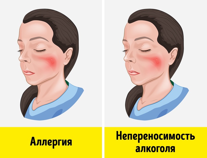 9 признаков алкогольной непереносимости, о которых многие не подозревают 9 признаков алкогольной непереносимости, о которых многие не подозревают