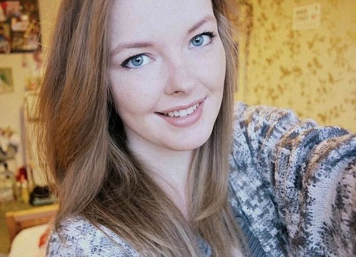 Британка страдает редким заболеванием, из-за которого спит большую часть жизнь Британка страдает редким заболеванием, из-за которого спит большую часть жизнь