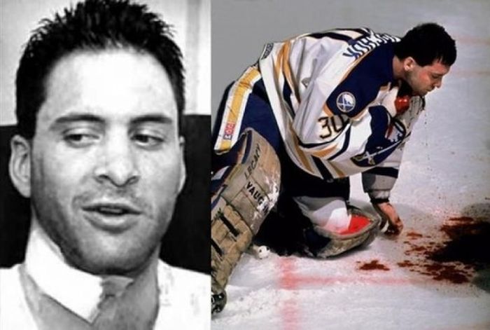 Спортсмены, жизнь которых сломали страшные травмы Спортсмены, жизнь которых сломали страшные травмы