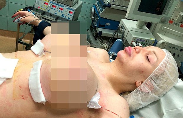 «Страшно красива», или на какие жертвы идут девушки, чтобы выглядеть лучше всех на свете? «Страшно красива», или на какие жертвы идут девушки, чтобы выглядеть лучше всех на свете?