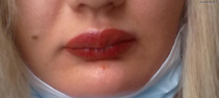 17 плачевных случаев, когда с татуажем губ что-то пошло не так 17 плачевных случаев, когда с татуажем губ что-то пошло не так
