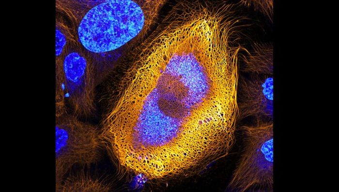 Лучшие работы фотоконкурса Nikon Small World