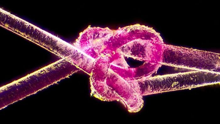 Лучшие работы фотоконкурса Nikon Small World