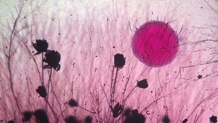 Лучшие работы фотоконкурса Nikon Small World