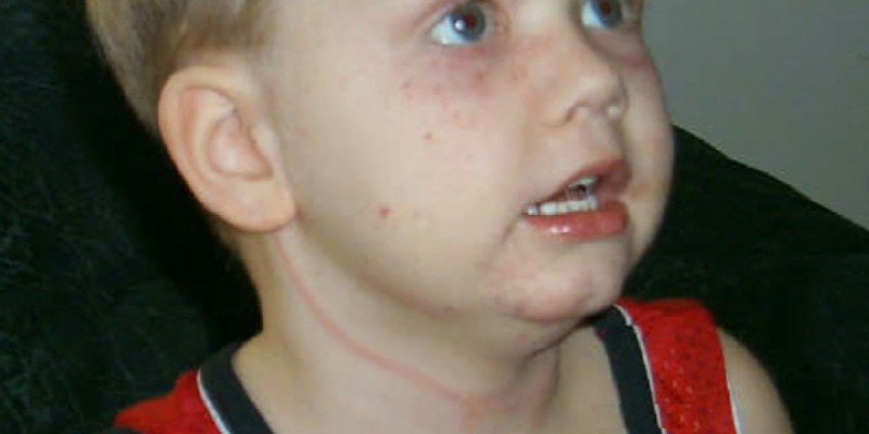 5-летний мальчик едва не погиб, запутавшись в жалюзи 5-летний мальчик едва не погиб, запутавшись в жалюзи