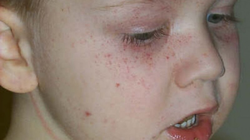 5-летний мальчик едва не погиб, запутавшись в жалюзи 5-летний мальчик едва не погиб, запутавшись в жалюзи