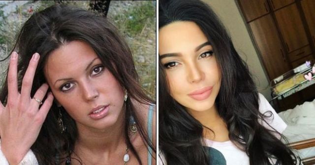 Российские звезды Instagram до и после пластических операций