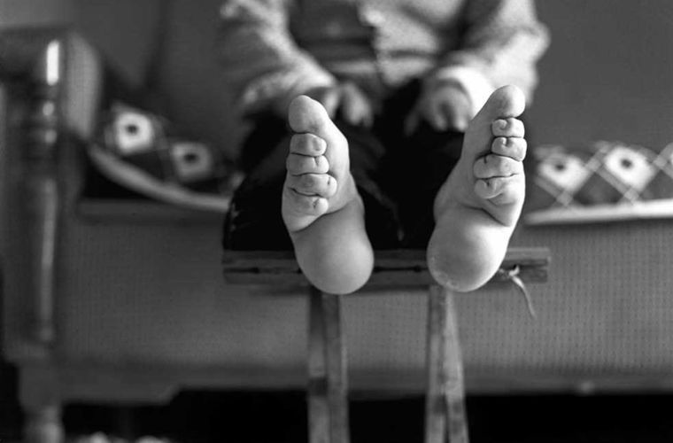 Страны, в которых увечья считаются красивыми Страны, в которых увечья считаются красивыми