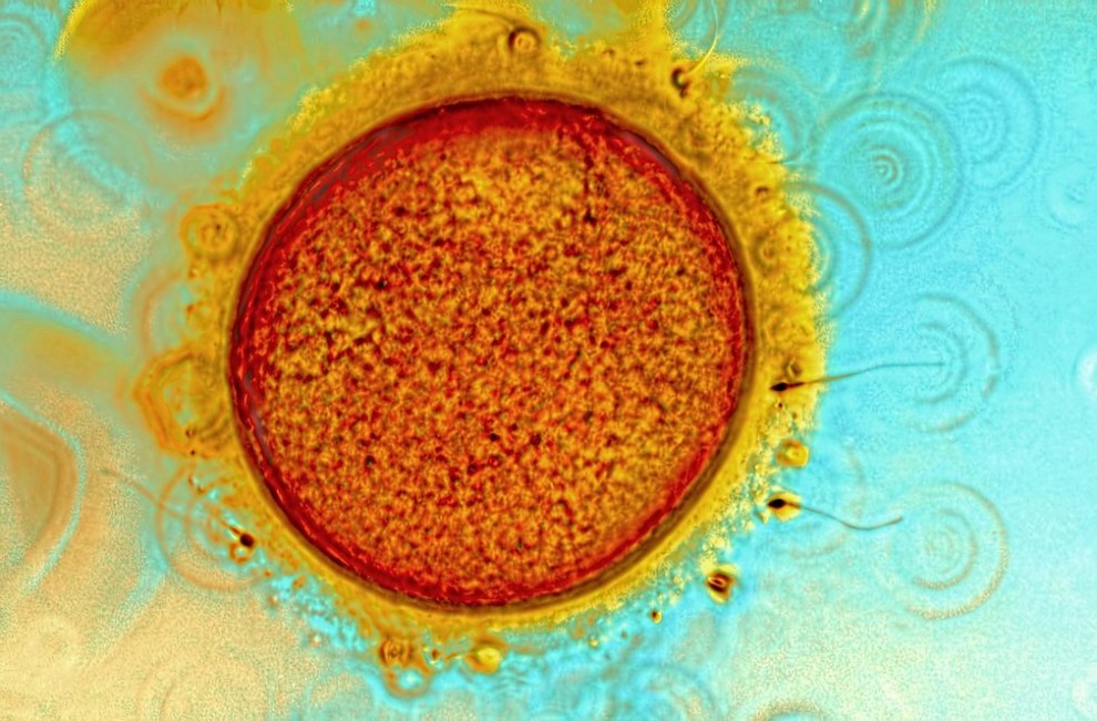 Мир под микроскопом: конкурс микрофотографии Королевского фотографического общества Мир под микроскопом: конкурс микрофотографии Королевского фотографического общества