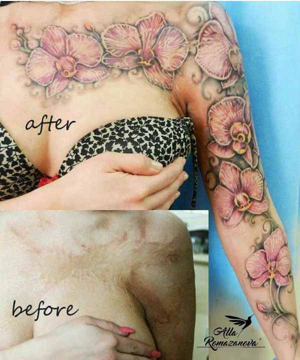 Шрам скрыли под татуировкой