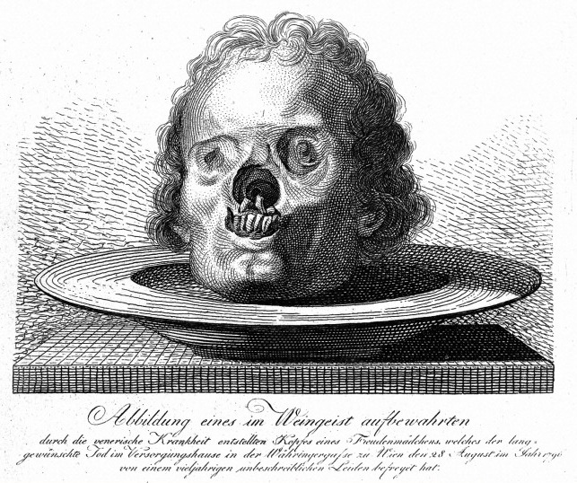 История «путешествия» сифилиса в Европу История «путешествия» сифилиса в Европу