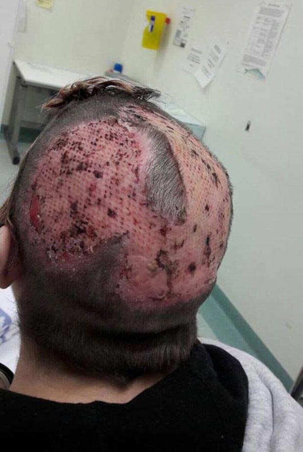 Девушка осталась практически лысой, пытаясь сделать себе волосы в стиле 'единорога' Девушка осталась практически лысой, пытаясь сделать себе волосы в стиле 'единорога'