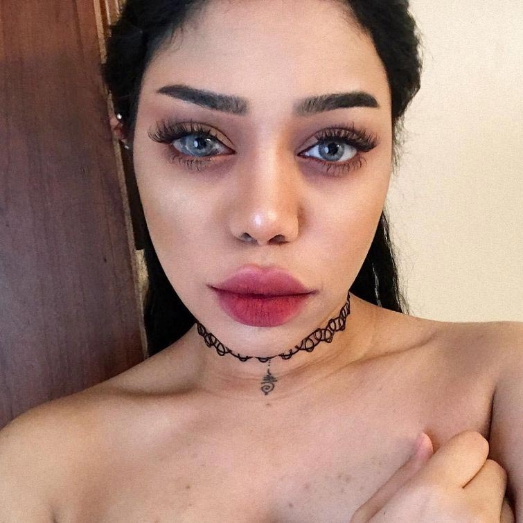 Что не так у девушки с глазом? Что не так у девушки с глазом?