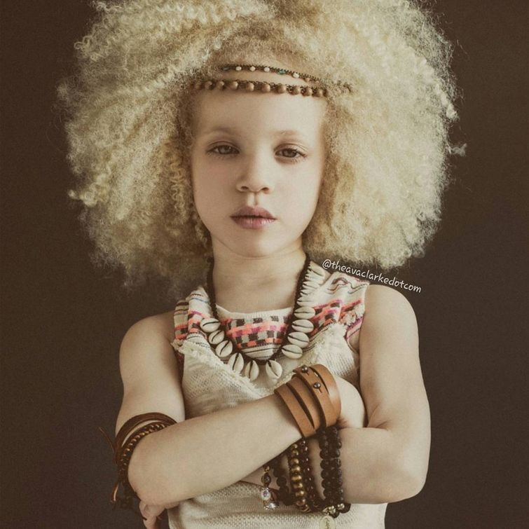 Ава Кларк – 8-летняя девочка-альбинос, ставшая юной афроамериканской моделью Ава Кларк – 8-летняя девочка-альбинос, ставшая юной афроамериканской моделью