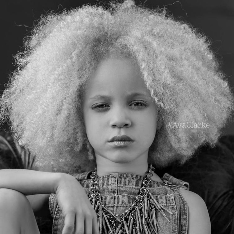 Ава Кларк – 8-летняя девочка-альбинос, ставшая юной афроамериканской моделью Ава Кларк – 8-летняя девочка-альбинос, ставшая юной афроамериканской моделью