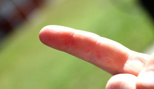 Домашняя медицина (27 фото)