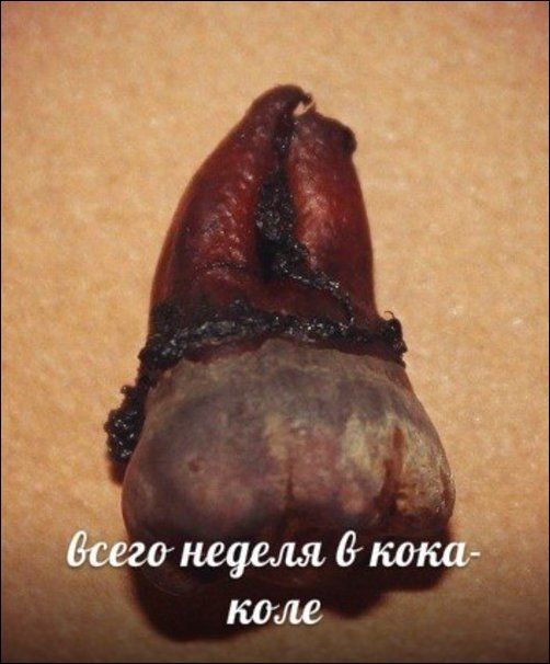Зубы и популярные напитки