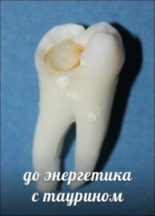 Зубы и популярные напитки