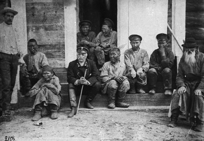 Жизнь прокаженных в Советском Союзе Жизнь прокаженных в Советском Союзе