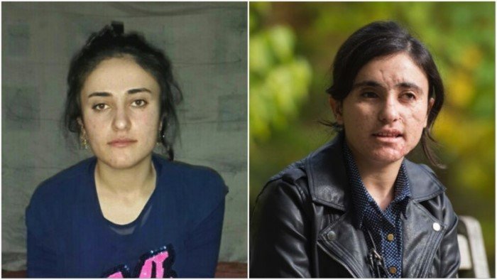 Несломленная: она два года была рабыней джихадистов, а убегая от них, наступила на мину… Несломленная: она два года была рабыней джихадистов, а убегая от них, наступила на мину…