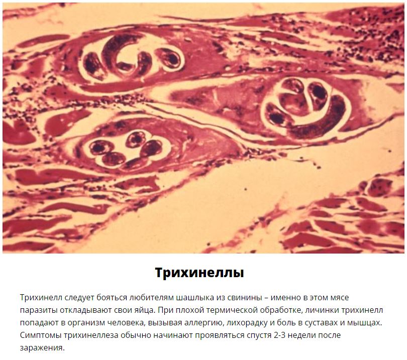 10 паразитов, которых следует опасаться летом