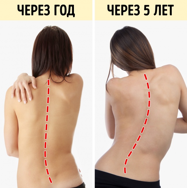10 вещей, которые происходят с вашим телом, когда вы сидите по 8 часов в день 10 вещей, которые происходят с вашим телом, когда вы сидите по 8 часов в день