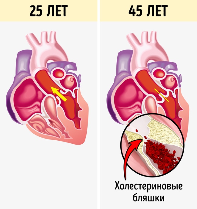 10 вещей, которые происходят с вашим телом, когда вы сидите по 8 часов в день 10 вещей, которые происходят с вашим телом, когда вы сидите по 8 часов в день