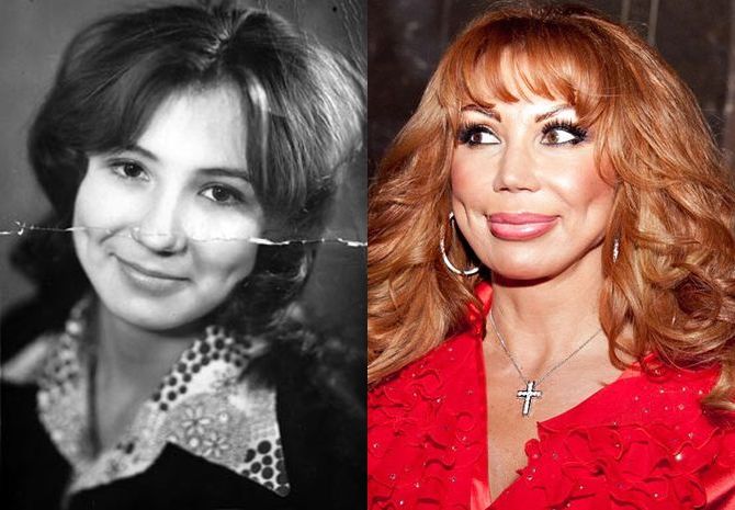 Превращения звезд. Знаменитости до и после пластических операций Превращения звезд. Знаменитости до и после пластических операций