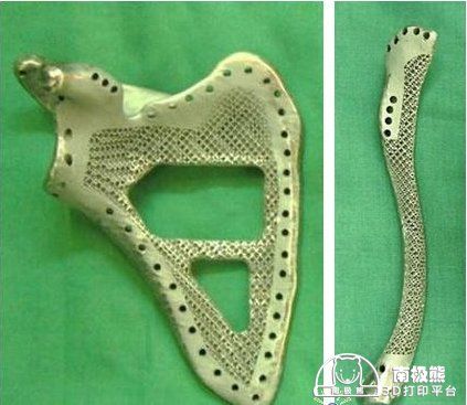 Титановые лопатки с помощью 3D-принтера Титановые лопатки с помощью 3D-принтера