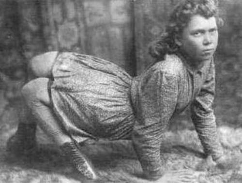 Женщины с редкими физическими недостатками, выступавшие в бродячих цирках Женщины с редкими физическими недостатками, выступавшие в бродячих цирках