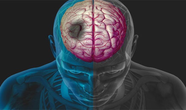 Каковы шансы умереть от того или иного бедствия? Каковы шансы умереть от того или иного бедствия?