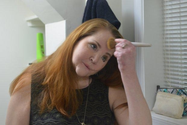 Женщина пережила попытку самоубийства, и рассказала о своей жизни после этого Женщина пережила попытку самоубийства, и рассказала о своей жизни после этого