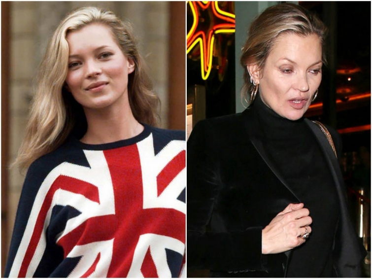 Другой человек: 10 звёзд Голливуда, которые изменились до неузнаваемости Другой человек: 10 звёзд Голливуда, которые изменились до неузнаваемости