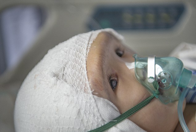 3-летней девочке в Китае пересадили череп, напечатанный на 3D-принтере 3-летней девочке в Китае пересадили череп, напечатанный на 3D-принтере