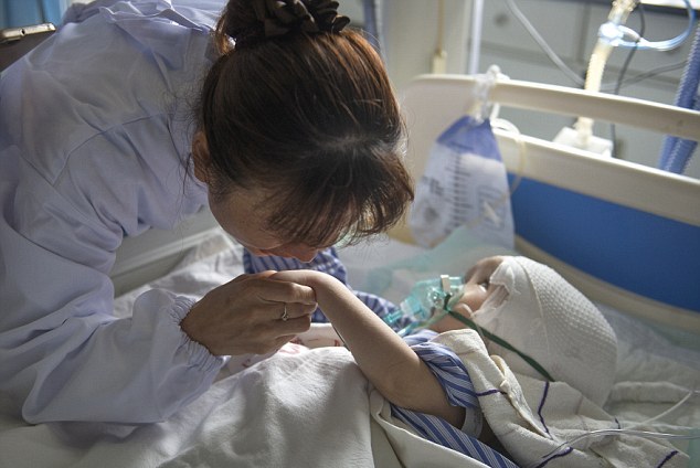 3-летней девочке в Китае пересадили череп, напечатанный на 3D-принтере 3-летней девочке в Китае пересадили череп, напечатанный на 3D-принтере