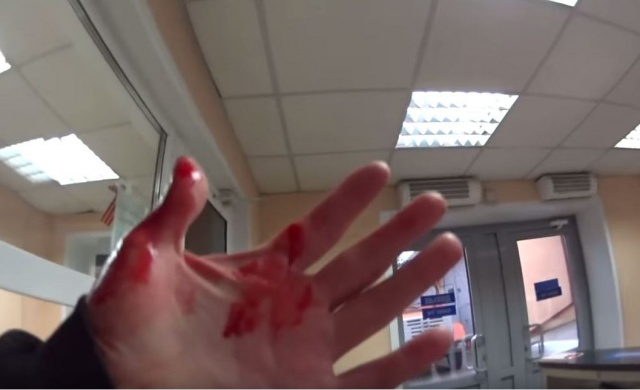 Звезду Рунета Бродягу Фишая избили дрелью в Красноярске Звезду Рунета Бродягу Фишая избили дрелью в Красноярске