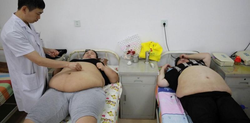 Китайские врачи назначают толстым пациентам банки