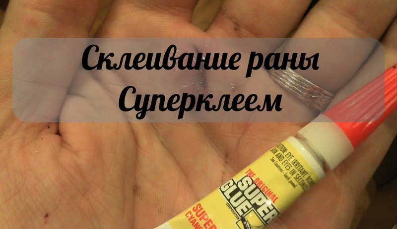 Простые советы, которые могут спасти вам жизнь Простые советы, которые могут спасти вам жизнь