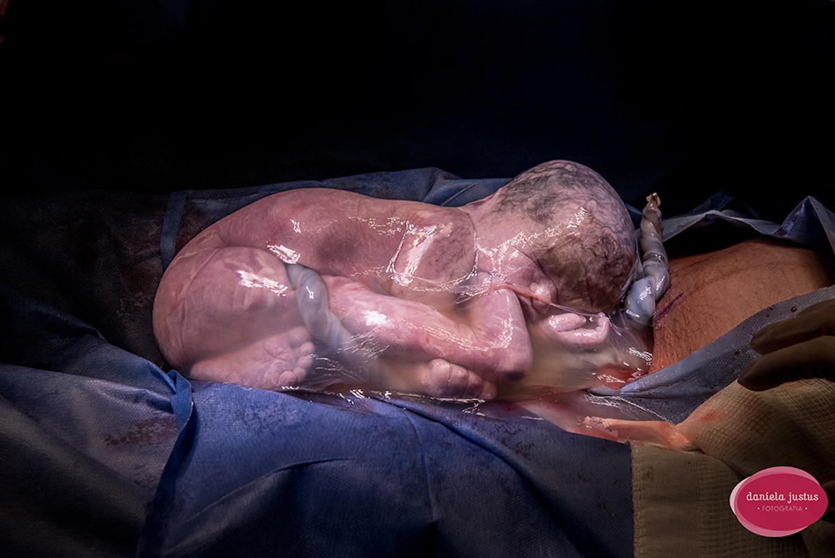 Победители международного конкурса Birth Photo Competition 2018 Победители международного конкурса Birth Photo Competition 2018