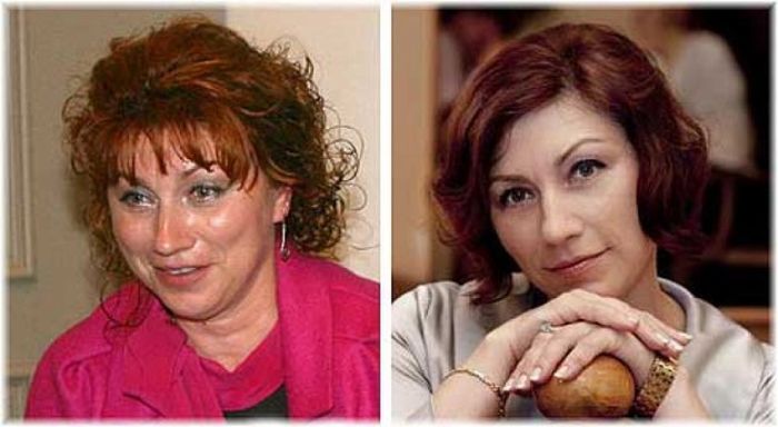 Звезды российского шоу-бизнеса до пластических операций и после них