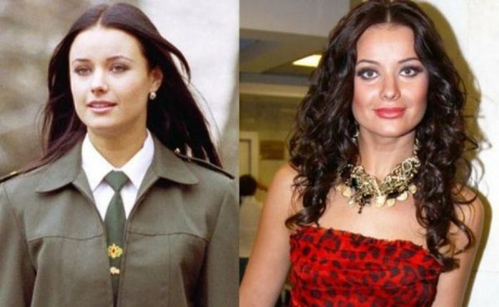 Звезды российского шоу-бизнеса до пластических операций и после них