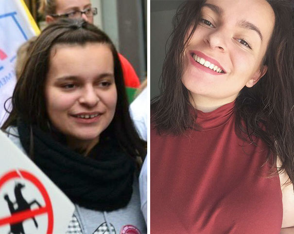 40 удивительных случаев, когда стоматологи творили чудеса 40 удивительных случаев, когда стоматологи творили чудеса
