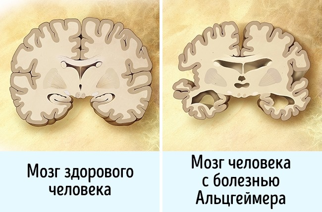 12 неожиданных вещей, которые вредят мозгу 12 неожиданных вещей, которые вредят мозгу
