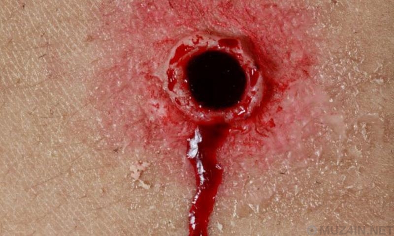 Ужасные эксперименты нацистов над людьми Ужасные эксперименты нацистов над людьми