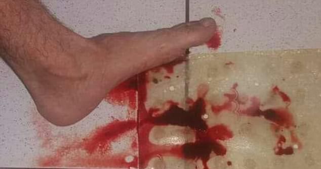 В Бразилии разбушевались вампиры - один человек умер и десятки людей обратились в больницу