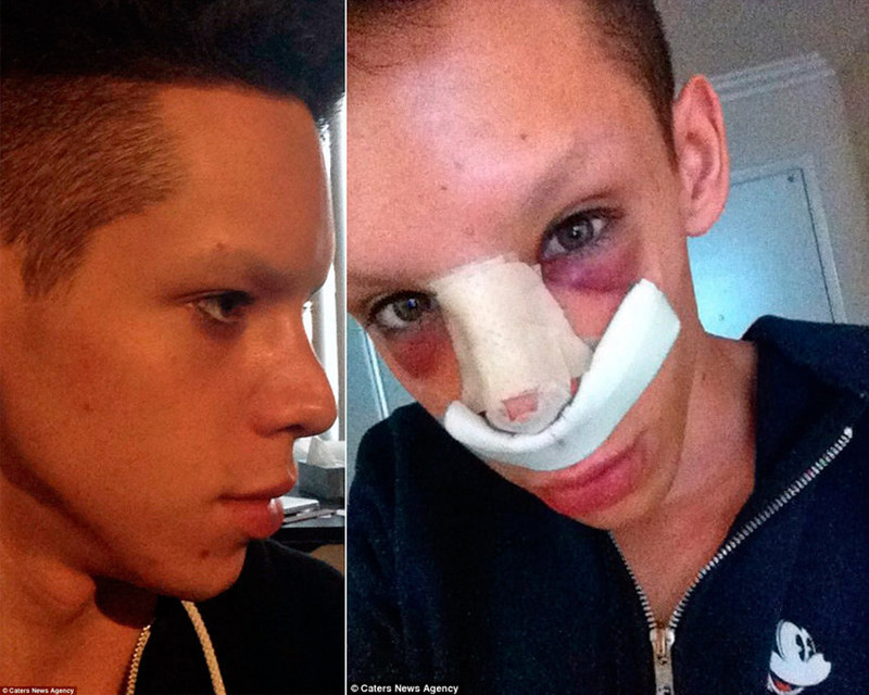 Трансформация в инопланетянина обошлась американцу в $50 000 Трансформация в инопланетянина обошлась американцу в $50 000