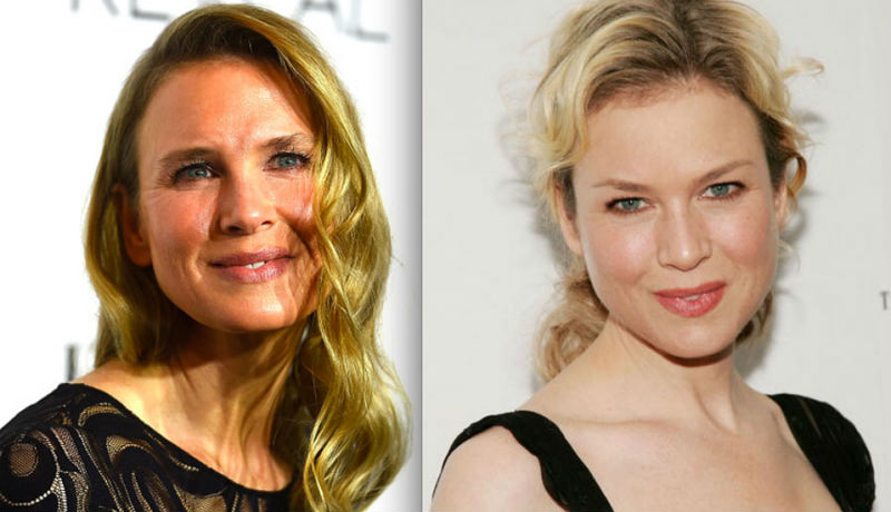 Знаменитости, которых изменил ботокс Знаменитости, которых изменил ботокс