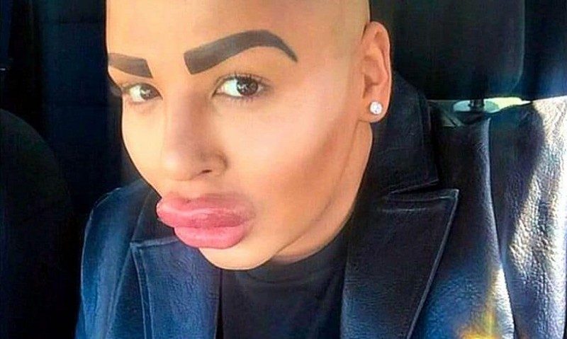 Мужчины, которые потратили тысячи долларов на пластику, чтобы быть похожими на своих кумиров Мужчины, которые потратили тысячи долларов на пластику, чтобы быть похожими на своих кумиров