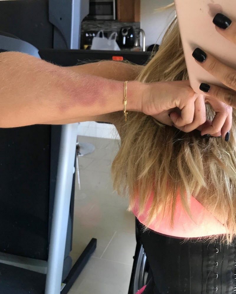 Фитнес-модель создавала иллюзию идеальной жизни, пока ее жестоко избивал бойфренд Фитнес-модель создавала иллюзию идеальной жизни, пока ее жестоко избивал бойфренд